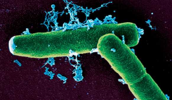 anthrax bacteria