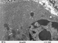 File:Clara cell lung - TEM.jpg