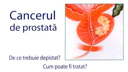 Află totul despre cancerul de prostată - cauze, simptome și tratament - prostatita.adonisfarm.ro