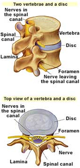 miscarile coloanei vertebrale)