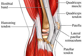 Patellar Tendonitis